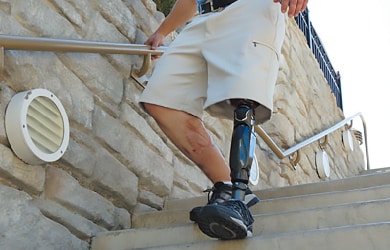 Carbon fiber composite materials for prosthetic legs