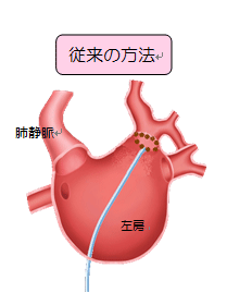 従来の方法