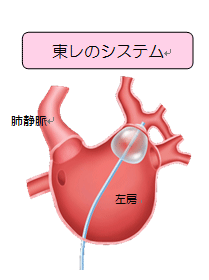 東レのシステム